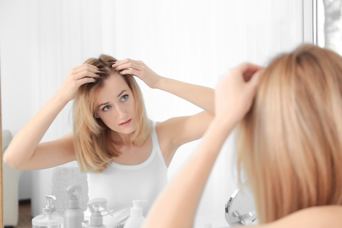 chute des cheveux femme alopécie causes